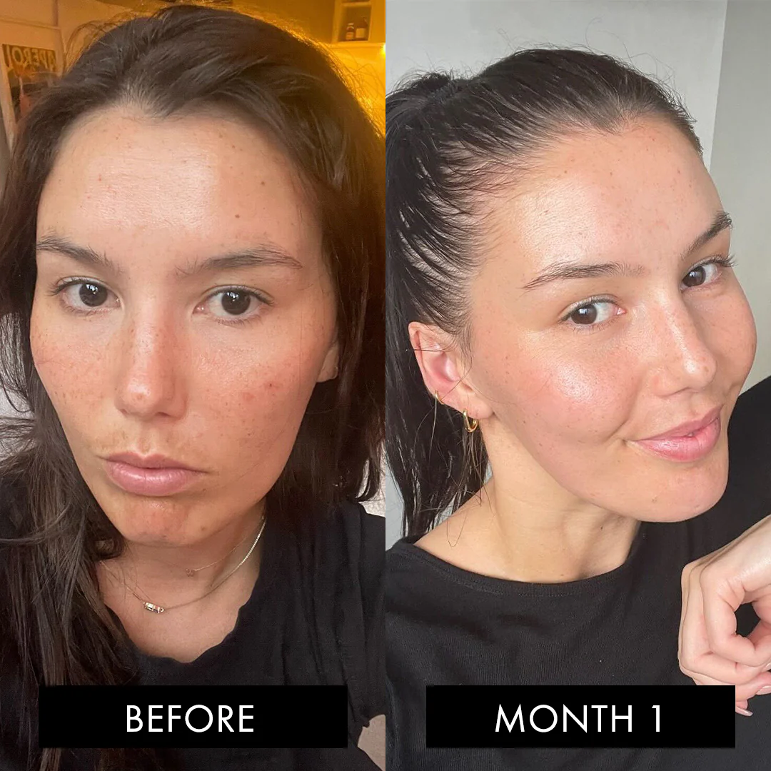 The Collagen Elixir Three Month Pack - Image 3