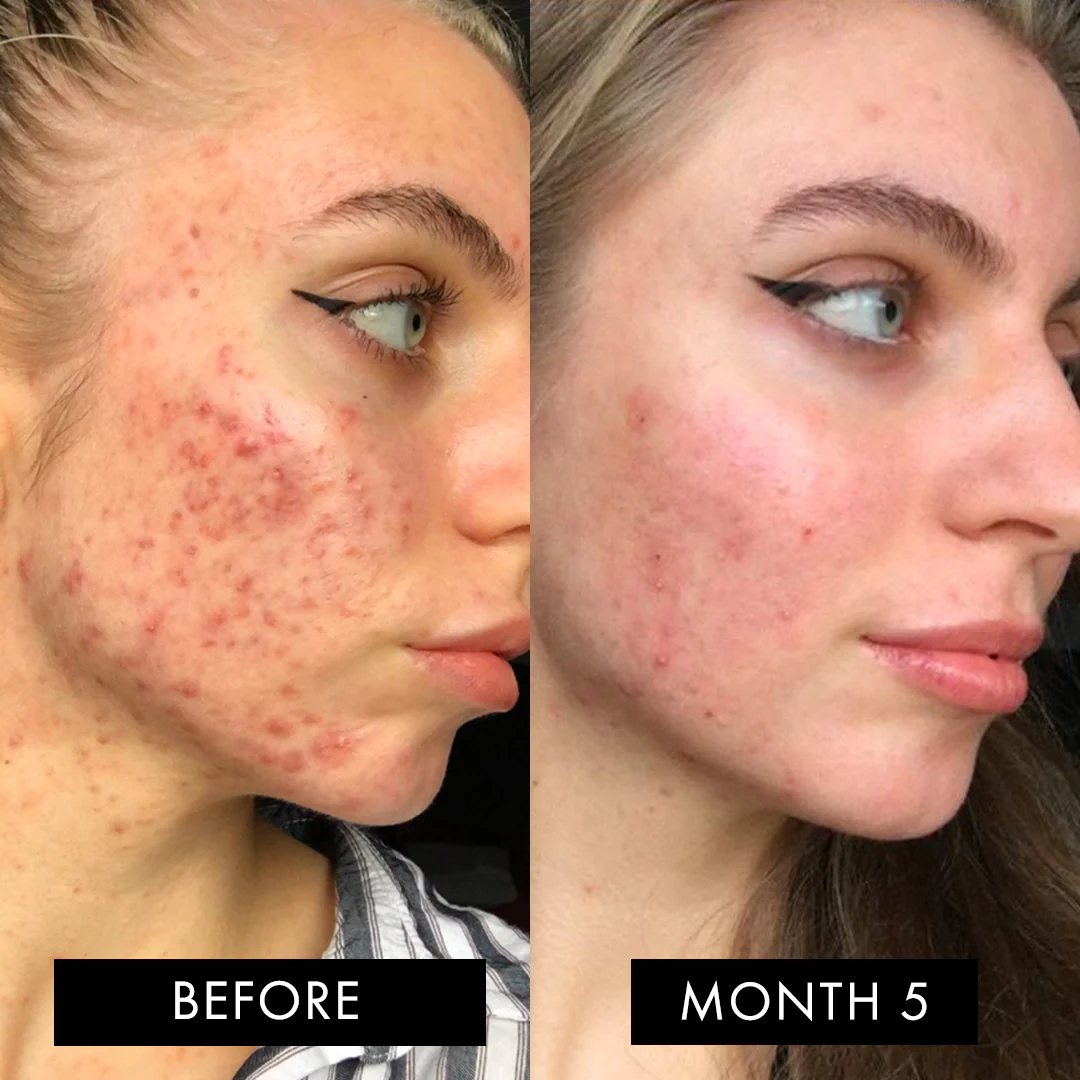 The Skin Elixir - Image 10