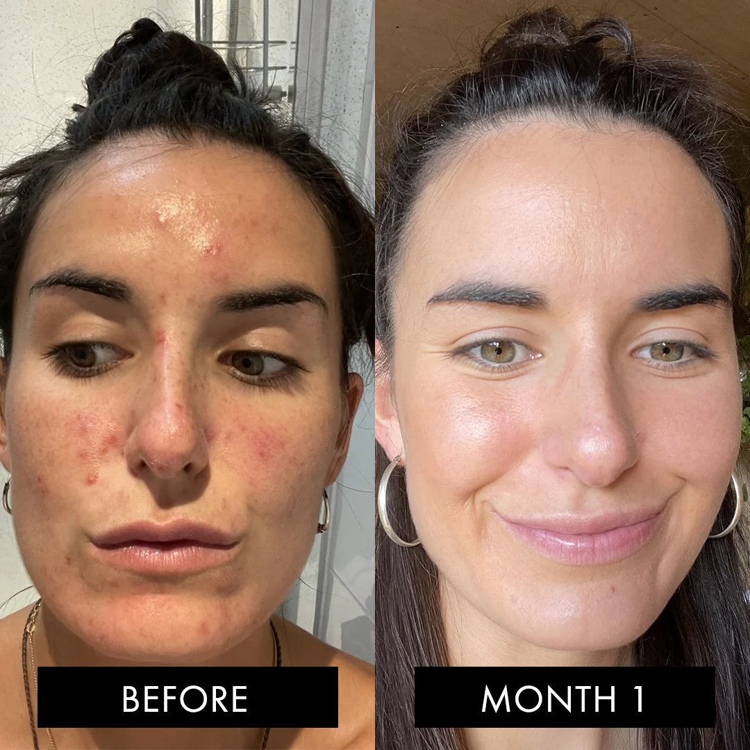 The Skin Elixir - Image 9