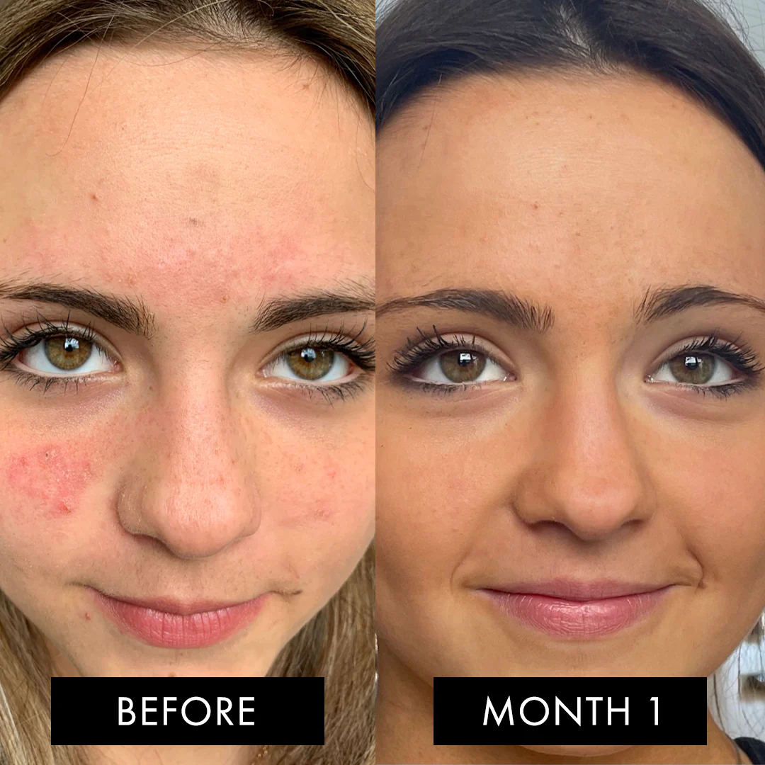 The Skin Elixir Three Month Pack - Image 7