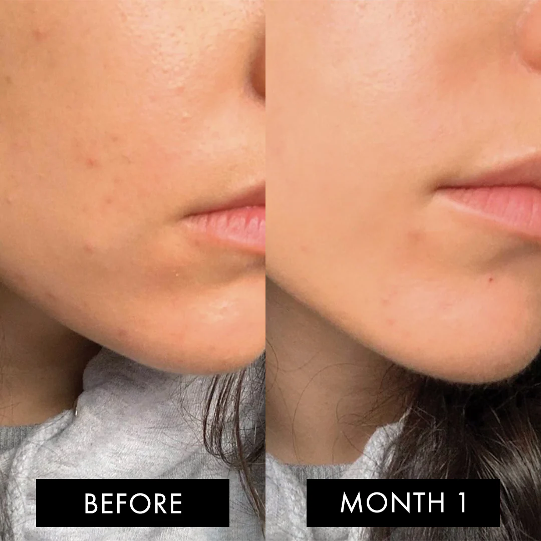 The Skin Elixir Three Month Pack - Image 9